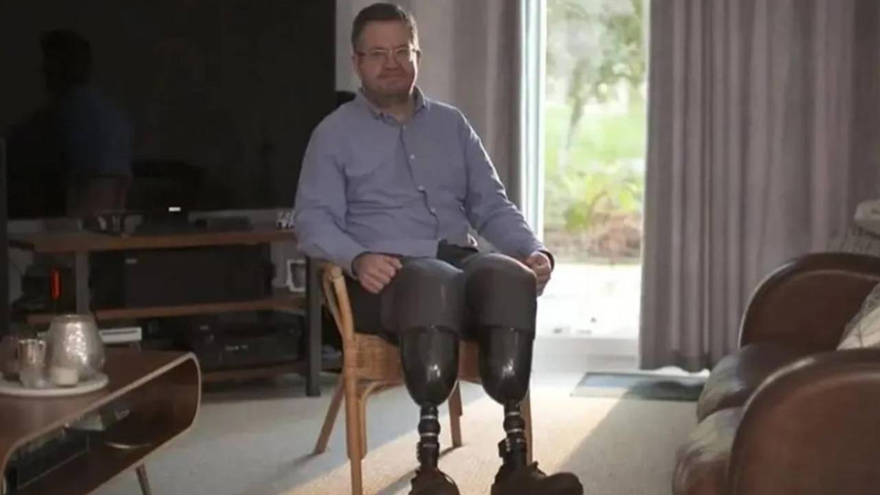 Damar cerrahından akıl almaz sigorta oyunu: Ayaklarını feda etti