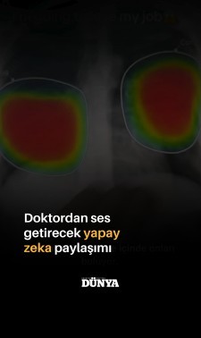 Story Yönlendirme 1 (YT SHORTS)