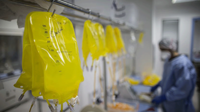 Kolon kanseri genetik mi? Nasıl önlem alabiliriz?