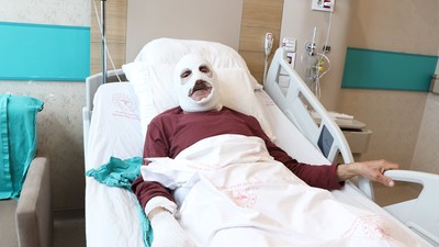 Bingöl'de mutfak tüpündeki gaz kaçağını çakmakla kontrol ederken gaz sıkışması nedeniyle meydana gel
