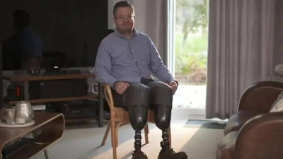 Damar cerrahından akıl almaz sigorta oyunu: Ayaklarını feda etti