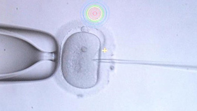 İngiltere'den üç ebeveynli bebeğe onay