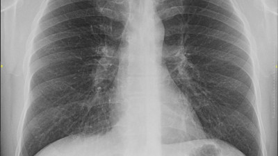 Sigarayı bırakmak için 400 poliklinik hizmet veriyor