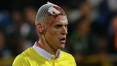 Fenerbahçe'de Skrtel'in başına 10 dikiş atıldı