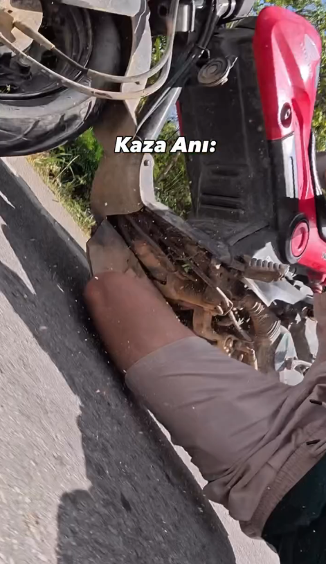 Sosyal medya fenomeni Mert Öztürk Dominik'te motosiklet kazası geçirdi! - Resim : 2