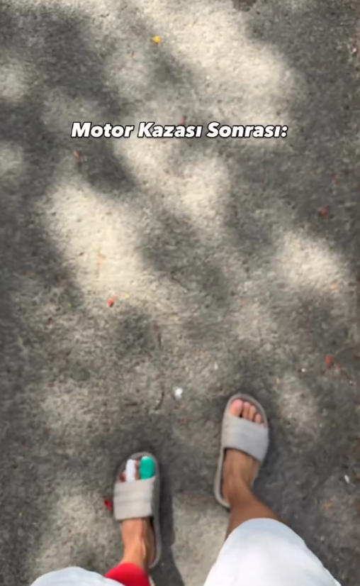 Sosyal medya fenomeni Mert Öztürk Dominik'te motosiklet kazası geçirdi! - Resim : 3