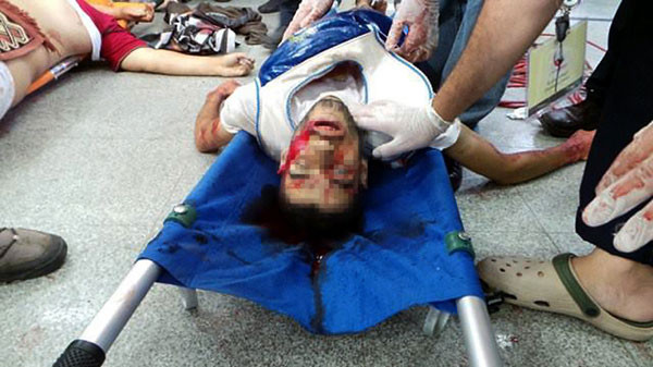 Mısır'da meydanlar kana bulandı - Resim: 2