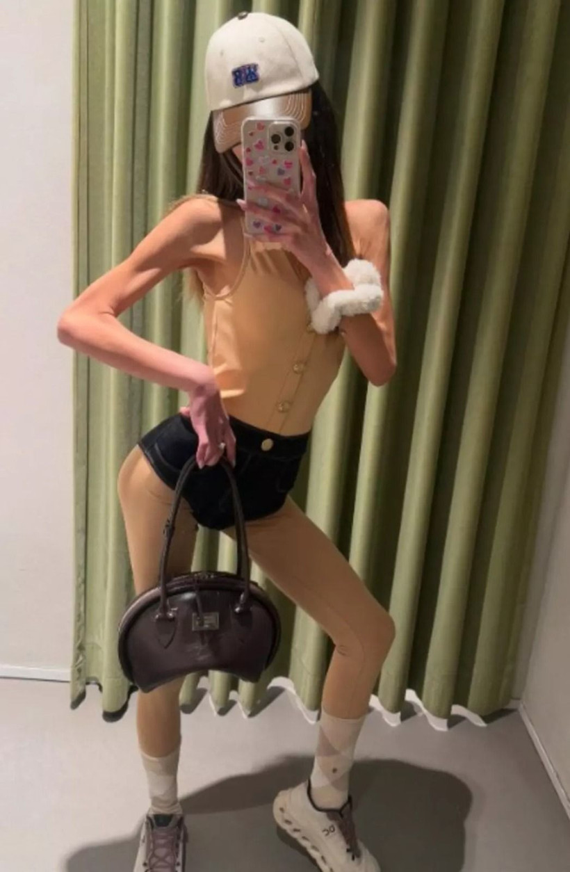 Anoreksiya nedeniyle tahliye edilmişti: Nihal Candan'ın son hali korkuttu! - Resim: 2