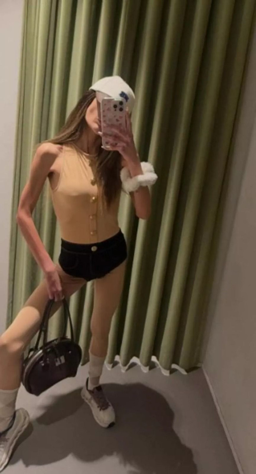 Anoreksiya nedeniyle tahliye edilmişti: Nihal Candan'ın son hali korkuttu! - Resim: 3