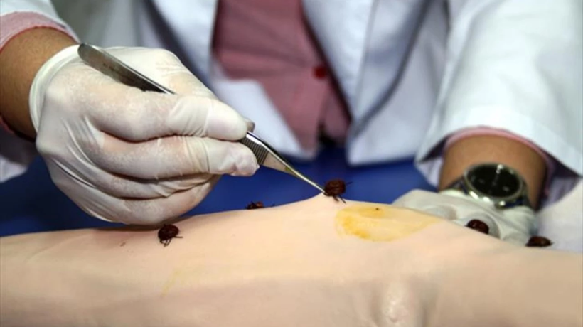 Kene ısırığıyla geçen esrarengiz hastalık: Et ve süte karşı anafilaksiye kadar giden alerjiye sebep oluyor! - Resim : 2