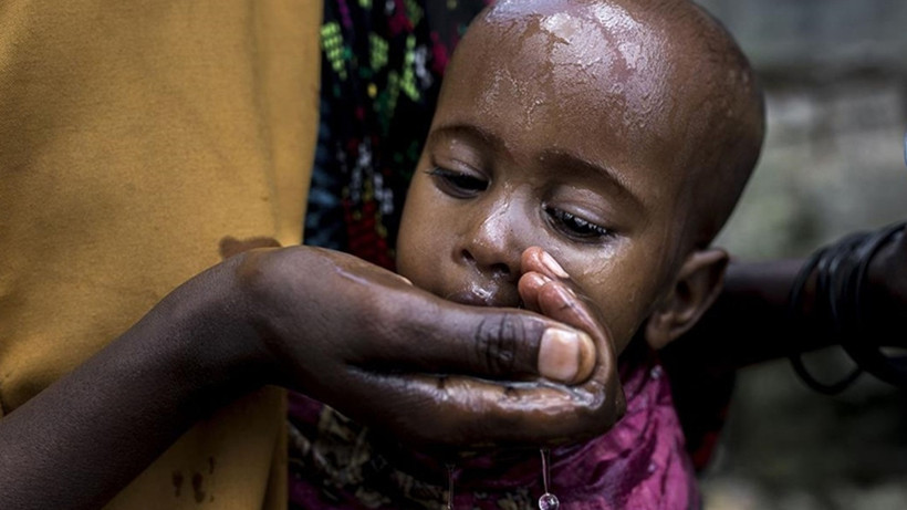 Sudan'da kolera salgını: 370 kişi hayatını kaybetti