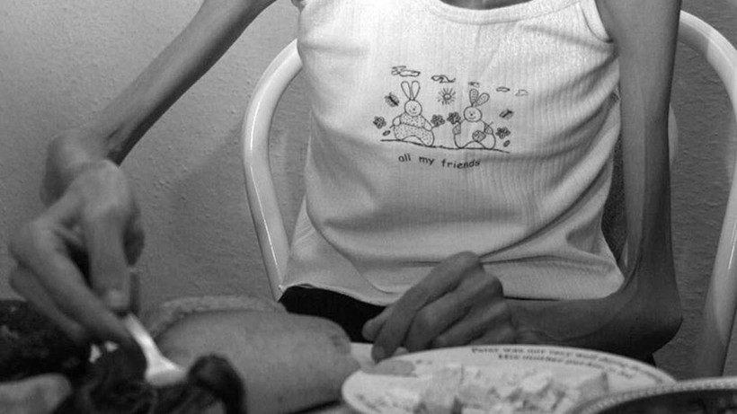 Anoreksiya nedir? Anoreksiya nevroza neden olur, tedavisi var mı? - Resim: 1