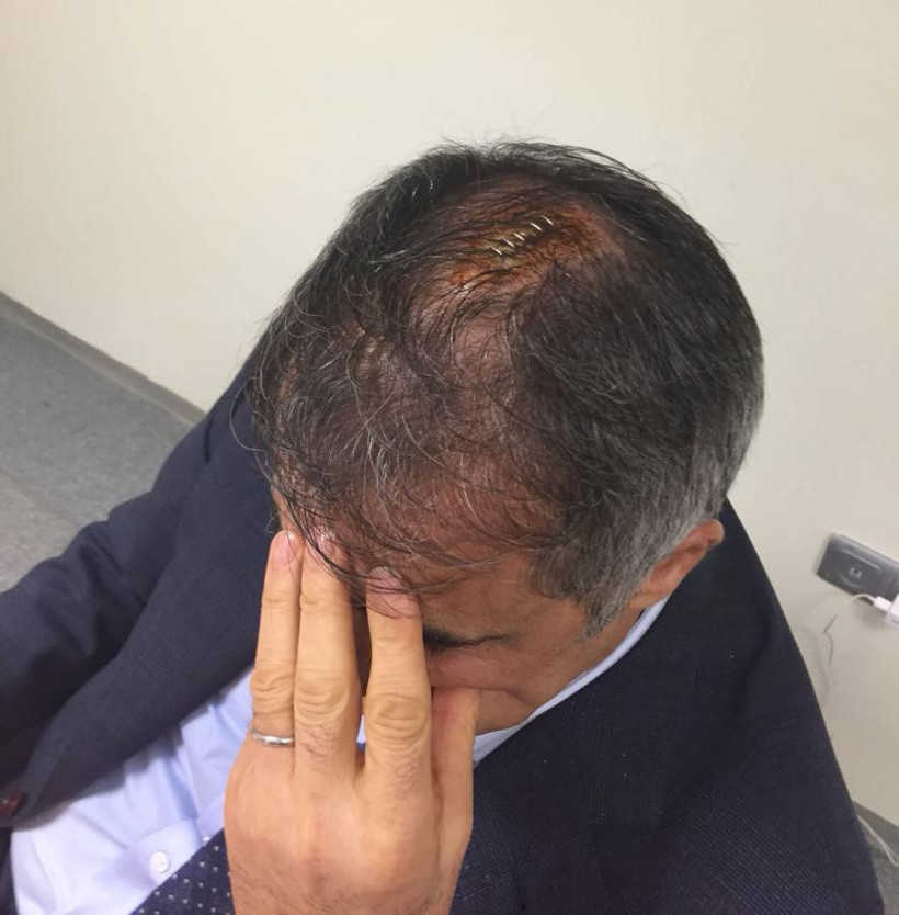 Olaylı kupa derbisinin ardından gözler TFF'de - Resim : 2