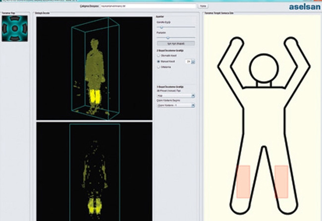 ASELSAN 'vücut tarayıcı' geliştiriyor - Resim : 1